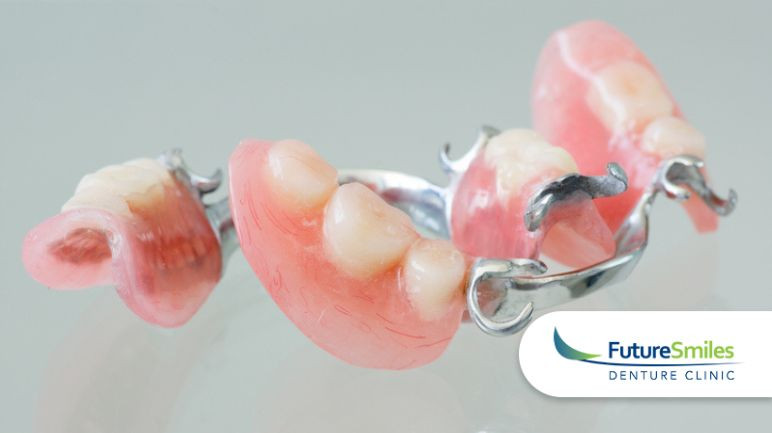 4 Benefits of Partial Dentures